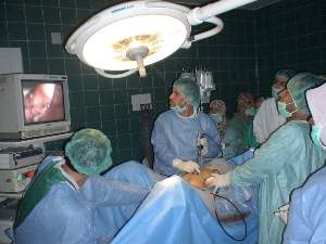 Laparoscopic Cholecystectomy