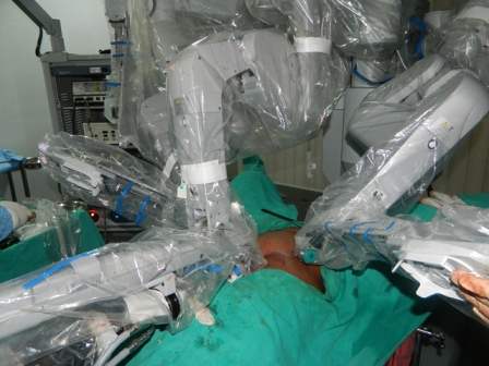 da Vinci Robotic Hysterectomy