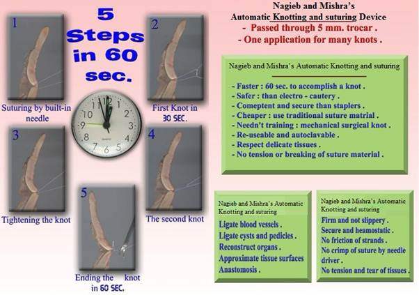 Guidelines for Surgical Treatment of Gastro esophageal Reflux Disease (GERD)