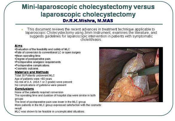 mini-laparoscopic cholecystectomy versus laparoscopic cholecystectomy