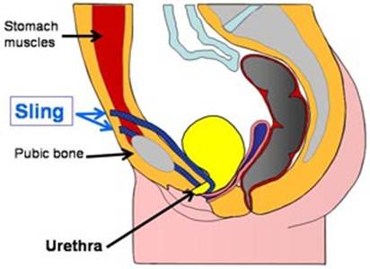 Minimal Access Surgery