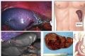 Laparoscopic Spenectomy, Varicelectomy, Retroperitoneoscopy for Surgeon and Colposcopy for Gynecologists