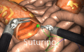 Hands On Suturing Training on Da Vinci Robot