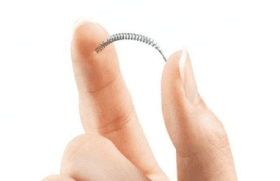 الجدل حول موانع الحمل من Essure