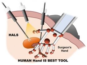 الجراحة قيد النظر في القرن العشرين