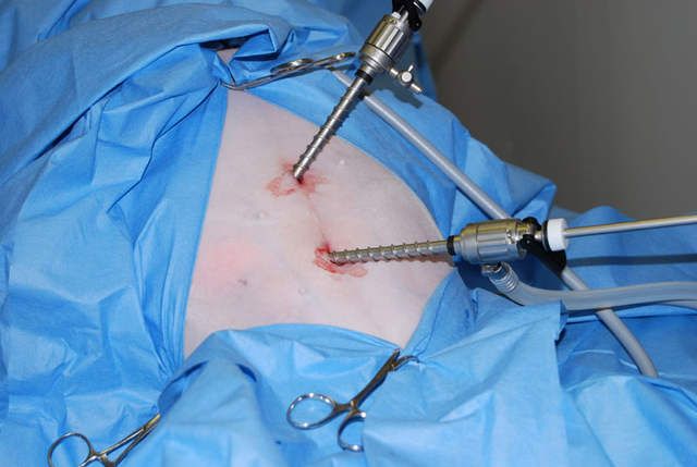 Laparoscopic Surgery Training Batch August 2016 at WLH
