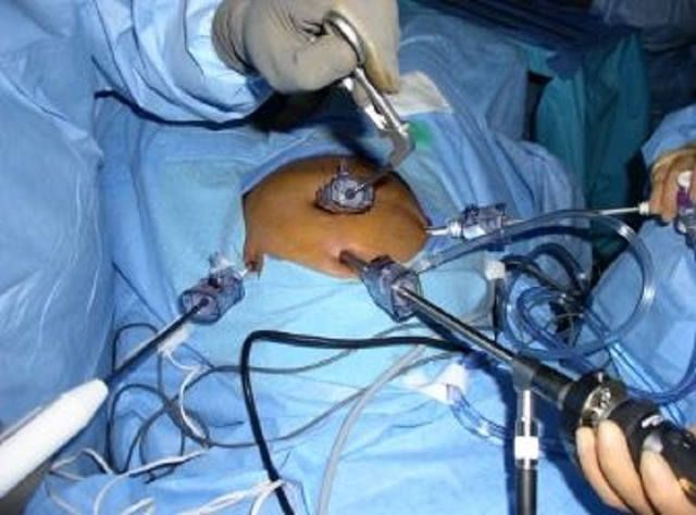 World Laparoscopy Hospital