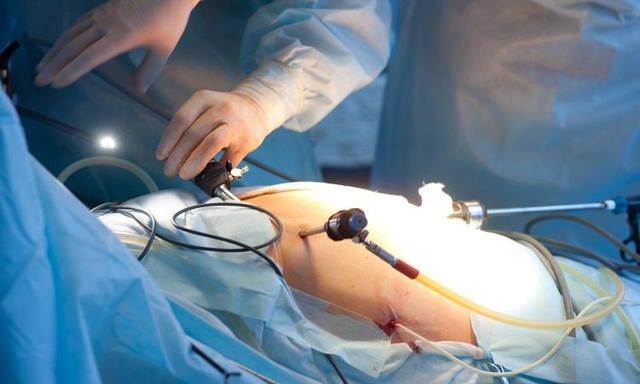 World Laparoscopy Hospital