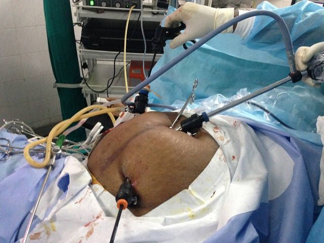 World Laparoscopy Hospital