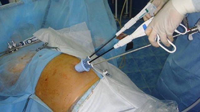 World Laparoscopy Hospital