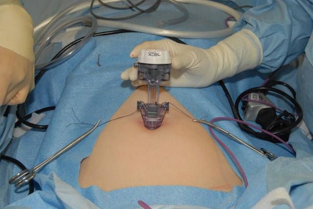 World Laparoscopy Hospital