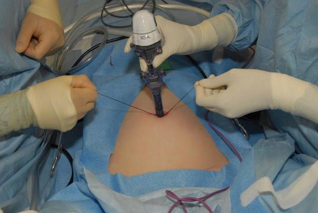 World Laparoscopy Hospital