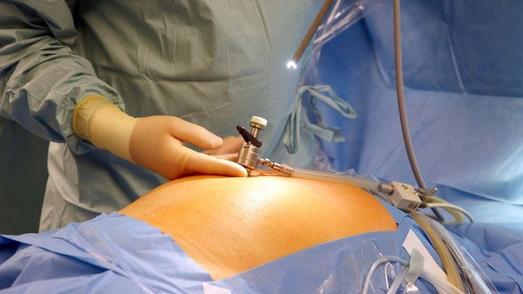 World Laparoscopy Hospital (INDIA-UAE)