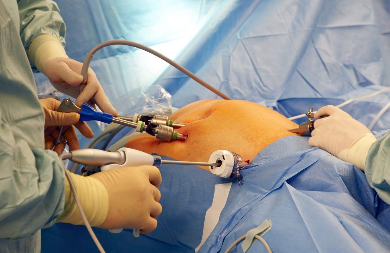 World Laparoscopy Hospital
