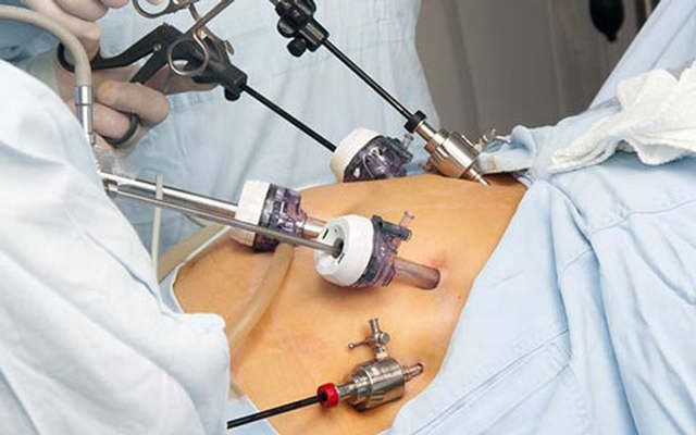 Laparoscopic Surgery Training