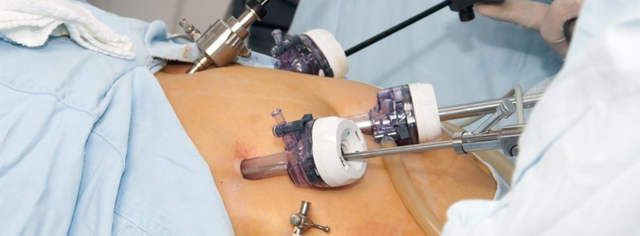 Laparoscopic Surgery Training