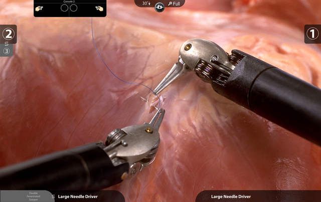 Laparoscopic Surgery Training