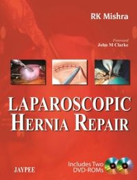 Laparoscopic Hernia Repair (Includes 2 DVD-Roms) - Dr. R.K. Mishra