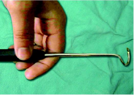 Aneurysm needle