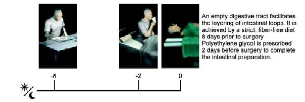 Bowel preparation in colorectal surgery