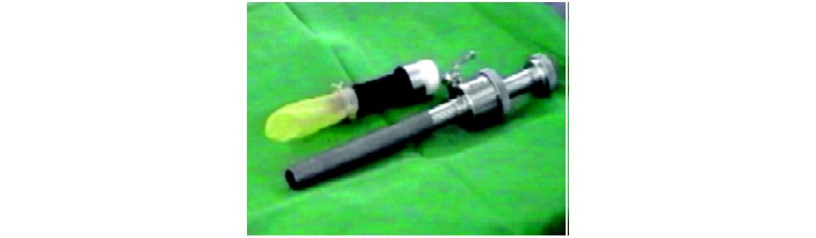 Finger of glove over sheath of cannula