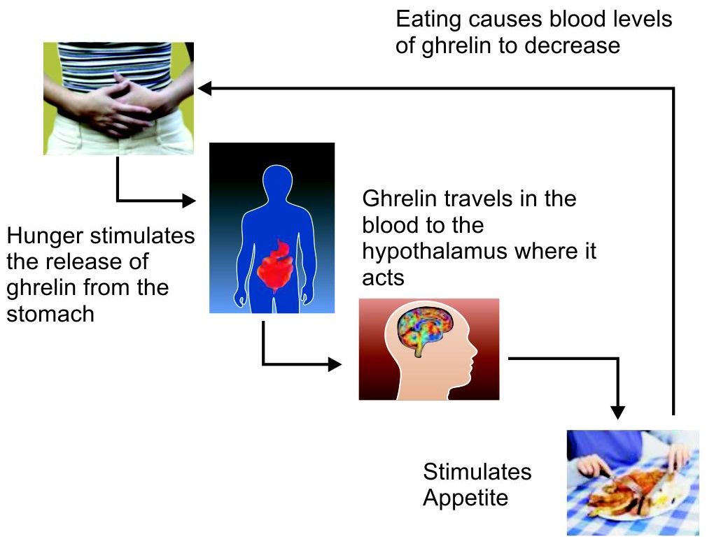 Obesity and Laparoscopic Sleeve Gastrectomy