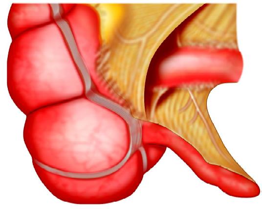 Normal appendix