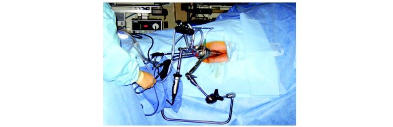 Patient position for lesion at right lateral position