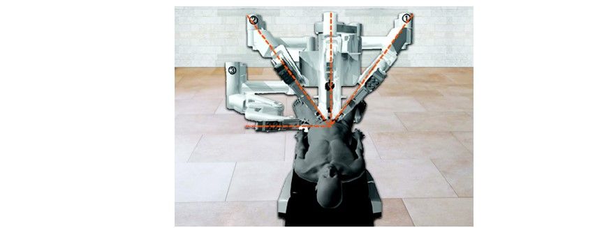 Relative positions of the instrument arms