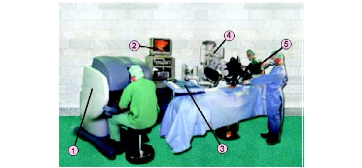 Robotic surgery (1) Surgeon console; (2) Image processing equipment; (3) Endowrist instruments; (4) Surgical arm cart; (5) Hi-resolution 3D endoscope