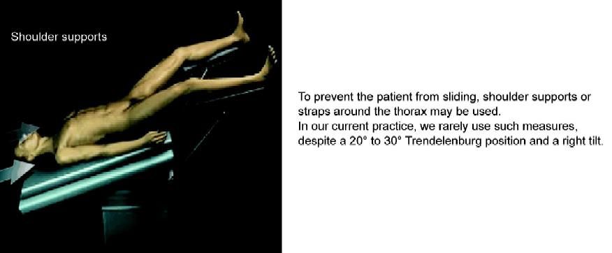 Shoulder support to prevent sliding during colorectal surgery