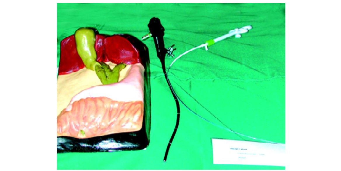 Simulated models of GB and CBD to improve choledochoscopic skill
