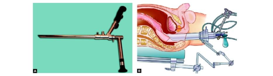 Stereoscope used in TEM