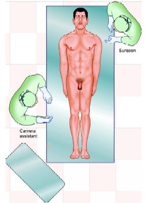 Position of surgeon in right sided hernia