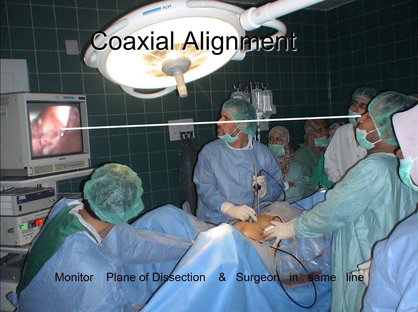 Surgeon stands to the left of patient in most of the right sided pathology