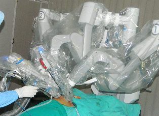 da vinci robotic ovarian cystectomy