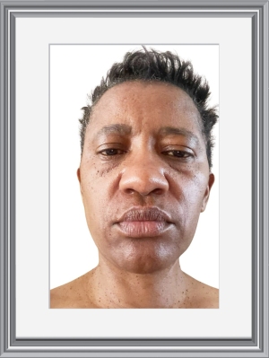 Dr. SIBONGILE ZUKISWA QUPE