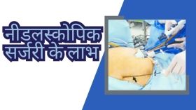 नीडलस्कोपिक सर्जरी के लाभ