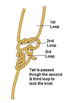 extracorporael knot clip