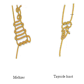 extracorporael knot clip