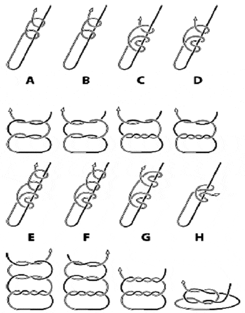 extracorporael knot clip