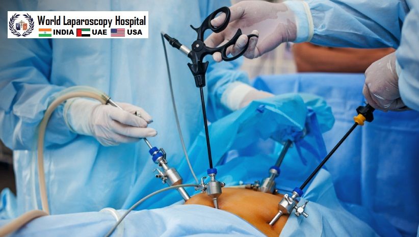 Laparoscopic Surgery