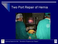 Two Port Laparoscopic Repair of Ventral Hernia
