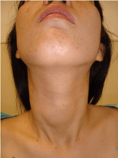 neck