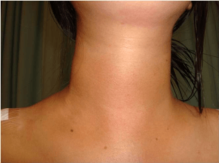 Neck