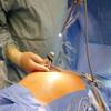 endoscopic surgery training
