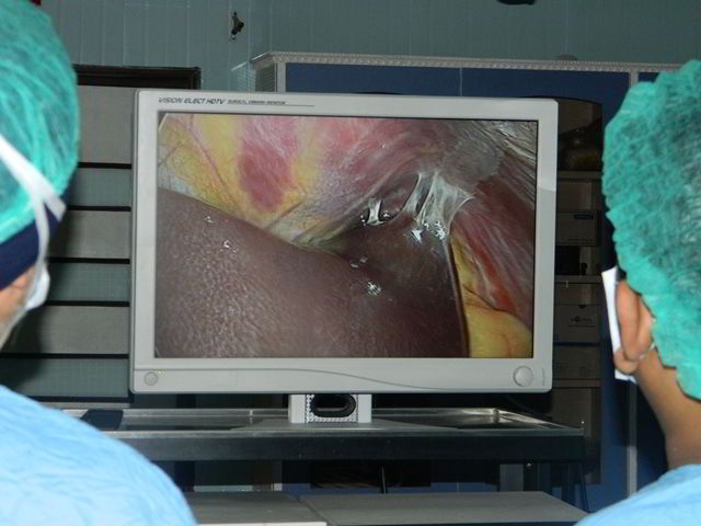 Laparoscopic Surgery Course