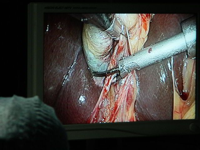 Laparoscopic Surgery Course