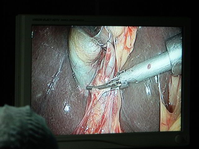 Laparoscopic Surgery Course