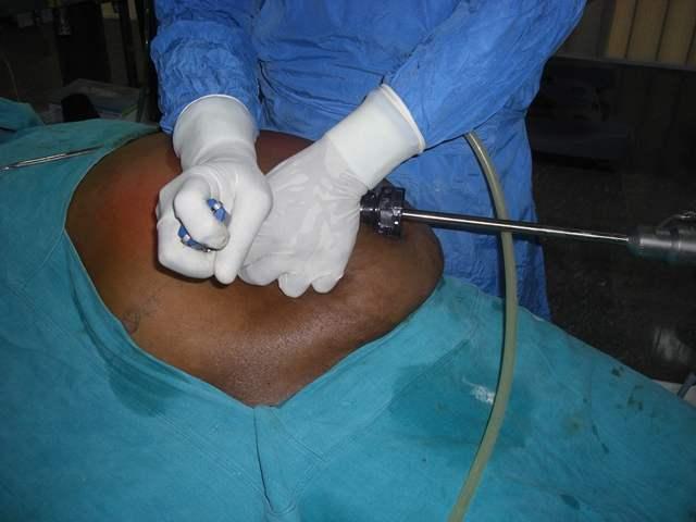World Laparoscopy Hospital